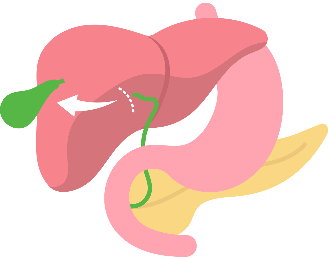 Cholecyste