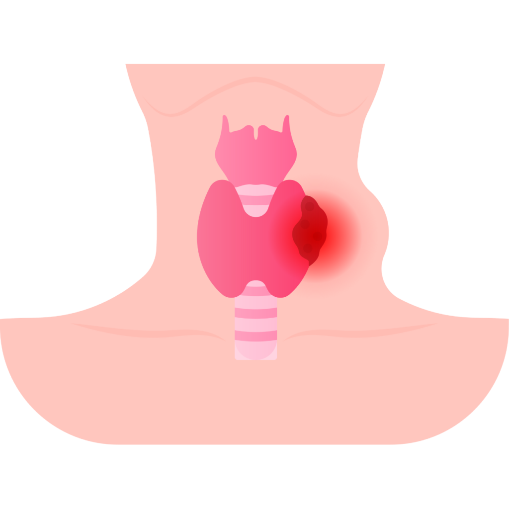 thyroid