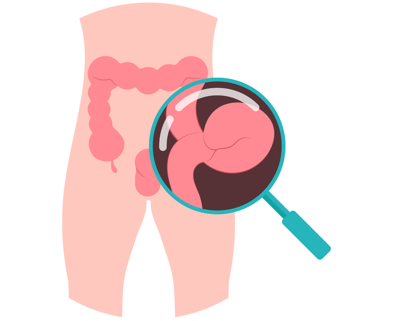 umbilical