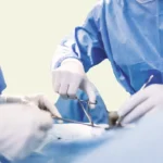 Circumcision Surgery