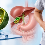 Understanding-Gallstones-Symptoms-Causes-Treatment